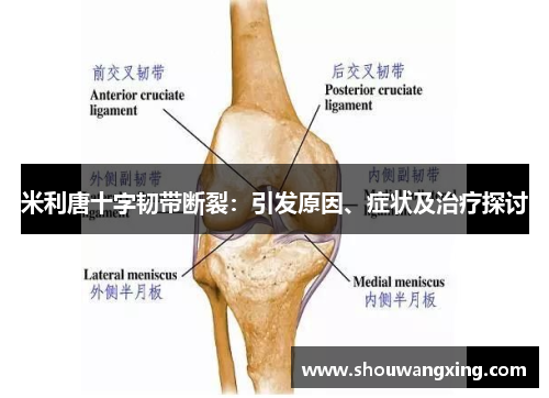 米利唐十字韧带断裂：引发原因、症状及治疗探讨